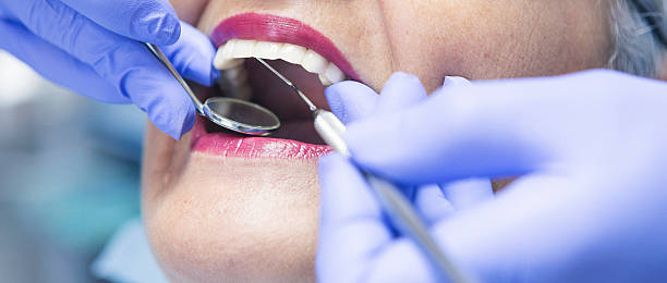 Best Emergency Root Canal Treatment in Little River, SC
